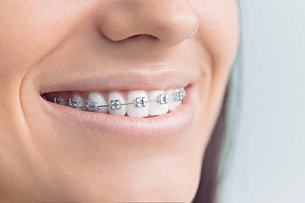 Best Traditional Braces  in Sterlington, LA
